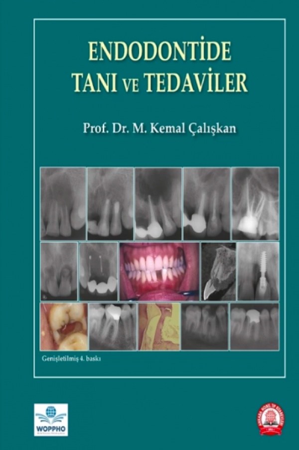 Endodontide-Tani-ve-Tedaviler