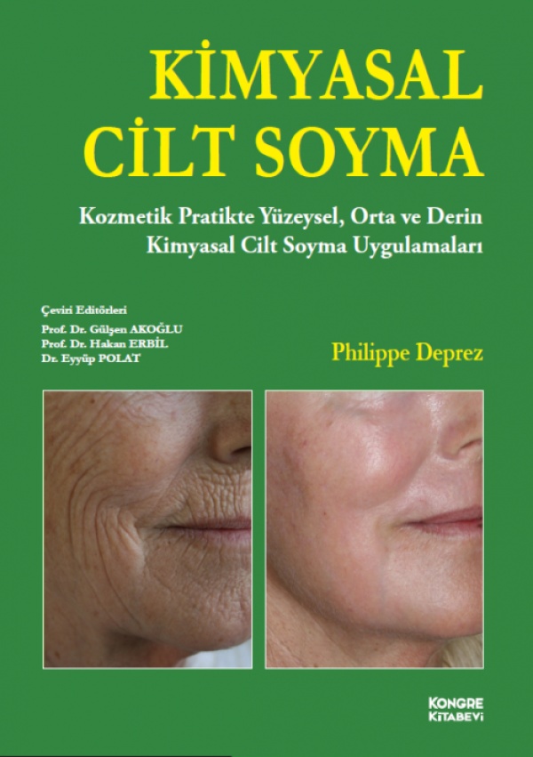 Kimyasal-Cilt-Soyma