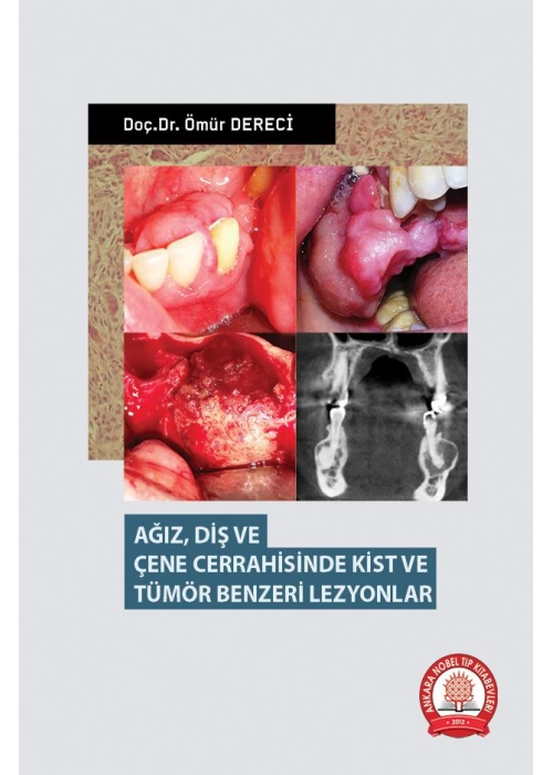 Agiz-Dis-ve-Cene-Cerrahisinde-Kist-ve-Tumor-Benzeri-Lezyonlar