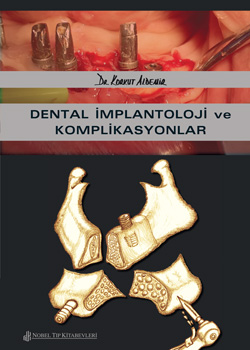Dental-Implantoloji-ve-Komplikasyonlar